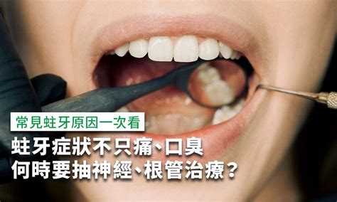 牙齒 單數|你也有蛀牙的毛病？知道英文怎麼說嗎？